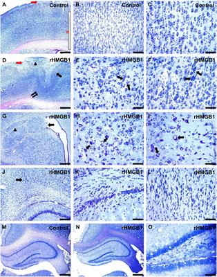 Abnormal Rat Cortical Development Induced by Ventricular Injection of rHMGB1 Mimics the Pathophysiology of Human Cortical Dysplasia